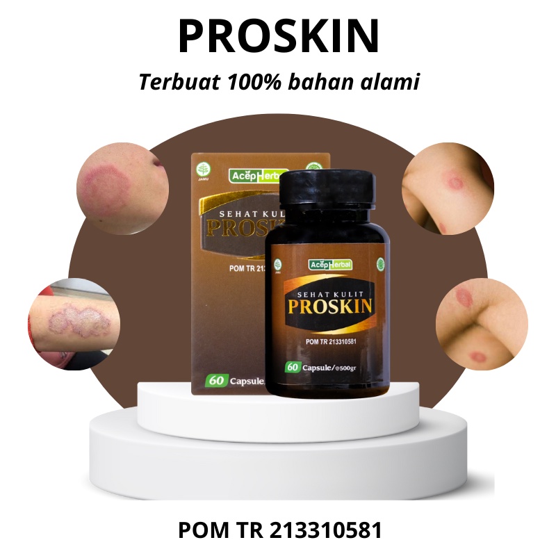 Kaka Herbal - Obat Jamur Kulit, Eksim, Panu, Herpes, Kurap, Kandidiasis, Obat infeksi jamur kulit, O