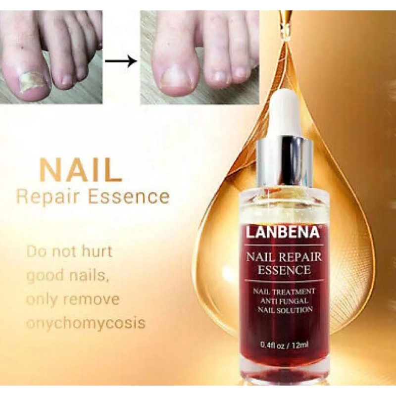 LANBENA NAIL REPAIR SERUM PERAWATAN KUKU KAKI TANGAN ANTI FUNGAL SERUM ESSENCE MEMPERBAIKI KUKU KAKI RUSAK-12ml