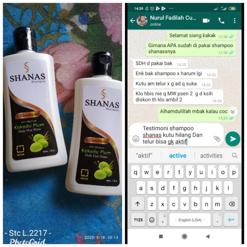 Shampo shanas pembasmi kutu