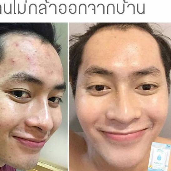 ♚ SABUN KOJIC MUKA 100% ORIGINAL THAILAND ➩