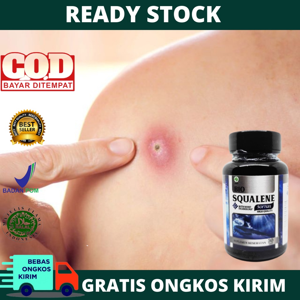 Obat Tradisional Untuk Bisul, Bisulan di Anus, Pantat, Bisul Bernanah, Obat Pengering Bisul, Obat Bi