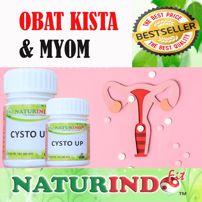 Obat sakit kista ovarium myom bengkak cysto up bagi penderita kista ampuh Cysto up naturindo COD