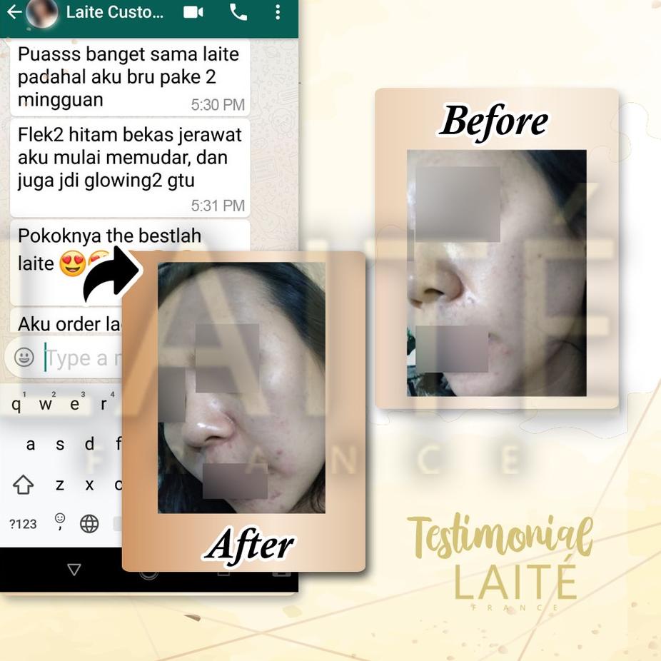 FREE ONGKIR!Laite Essential Paket Glowing/Brightening/Whitening / Perawatan Wajah / Skincare Dokter 