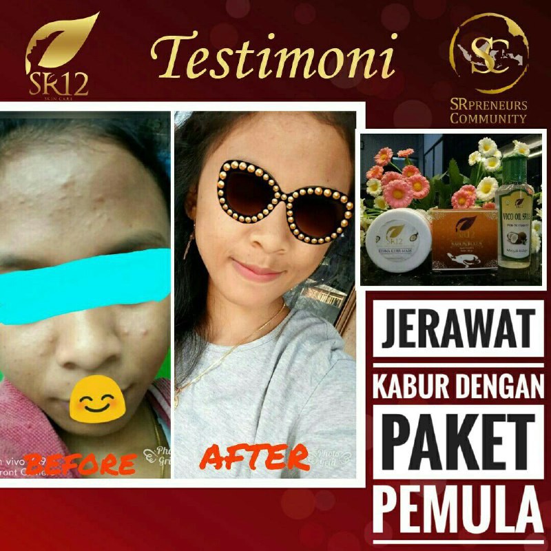 KEFIR ETAWA MASKER SR12  BPOM TERBAIK KULIT BERMINYAK &amp; SENSITIF / KEFIR MASK SUSU KAMBING ETAWA