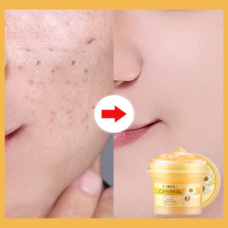 lulur pemutih badan herborist body scrub lulur mandi 250g permanen dan alami Body &amp; Face Scrub Whitening Peeling Kulit Ayam kulit memutihkan badan/memutihkan kulit/memutihkan tangan
