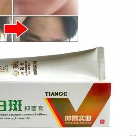 ➵ VITILIGO ORI 100% SEMBUH Tiange cream psolaren solaren import ♧