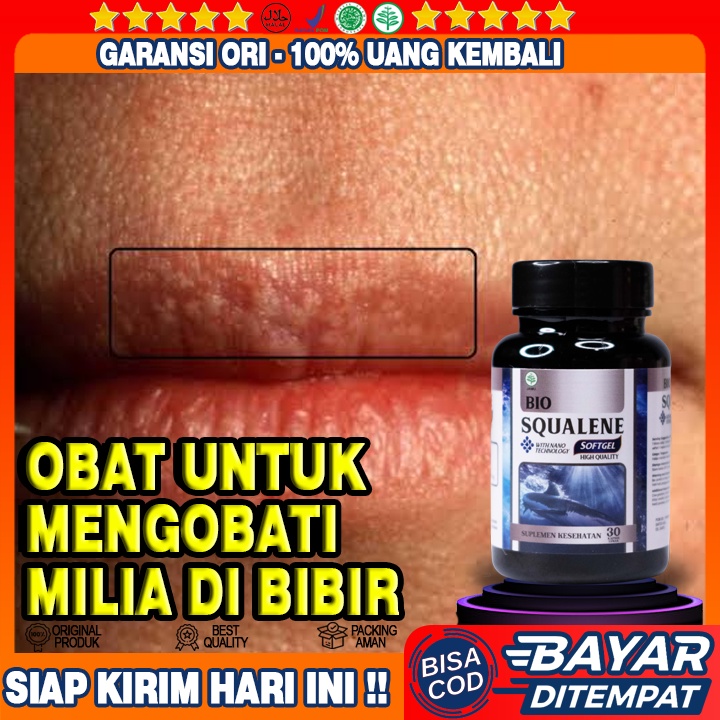 Obat Milia Di Bibir - Obat Herbal Milia Di Bibir - Obat Bintik Putih Di Bibir - Obat Herpes Di Bibir