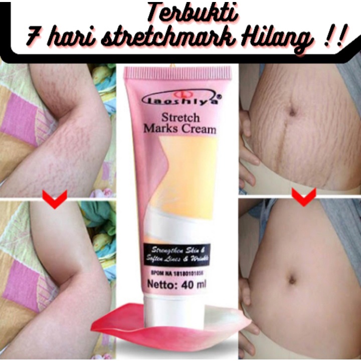 [BSIA COD] Strecth Mark Cream Laoshiya Penghilang Strechmark Penghilang Bekas Luka Penghilang Keloid Selulit