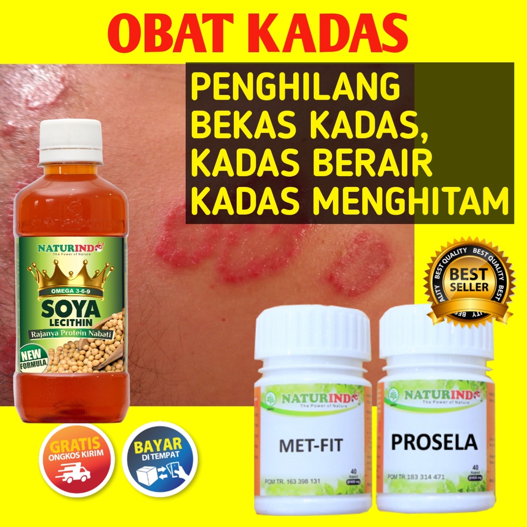 Jual Obat Kadas Obat Kadas Kurap Jamur Selangkangan Obat Kadas Kurap