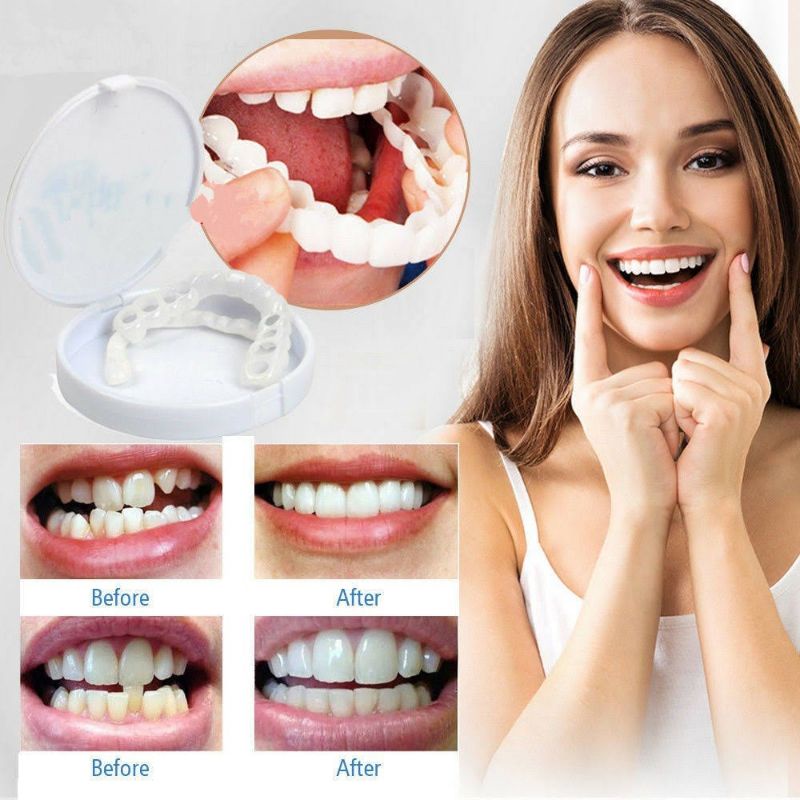 Snap On Smile Gigi Palsu Mainan | Set Atas Bawah Original 100% GROSIR dan ECER