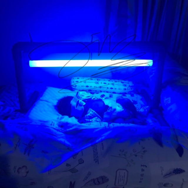 Sewa Lampu Sinar Biru Bilirubin Bayi Shopee Indonesia