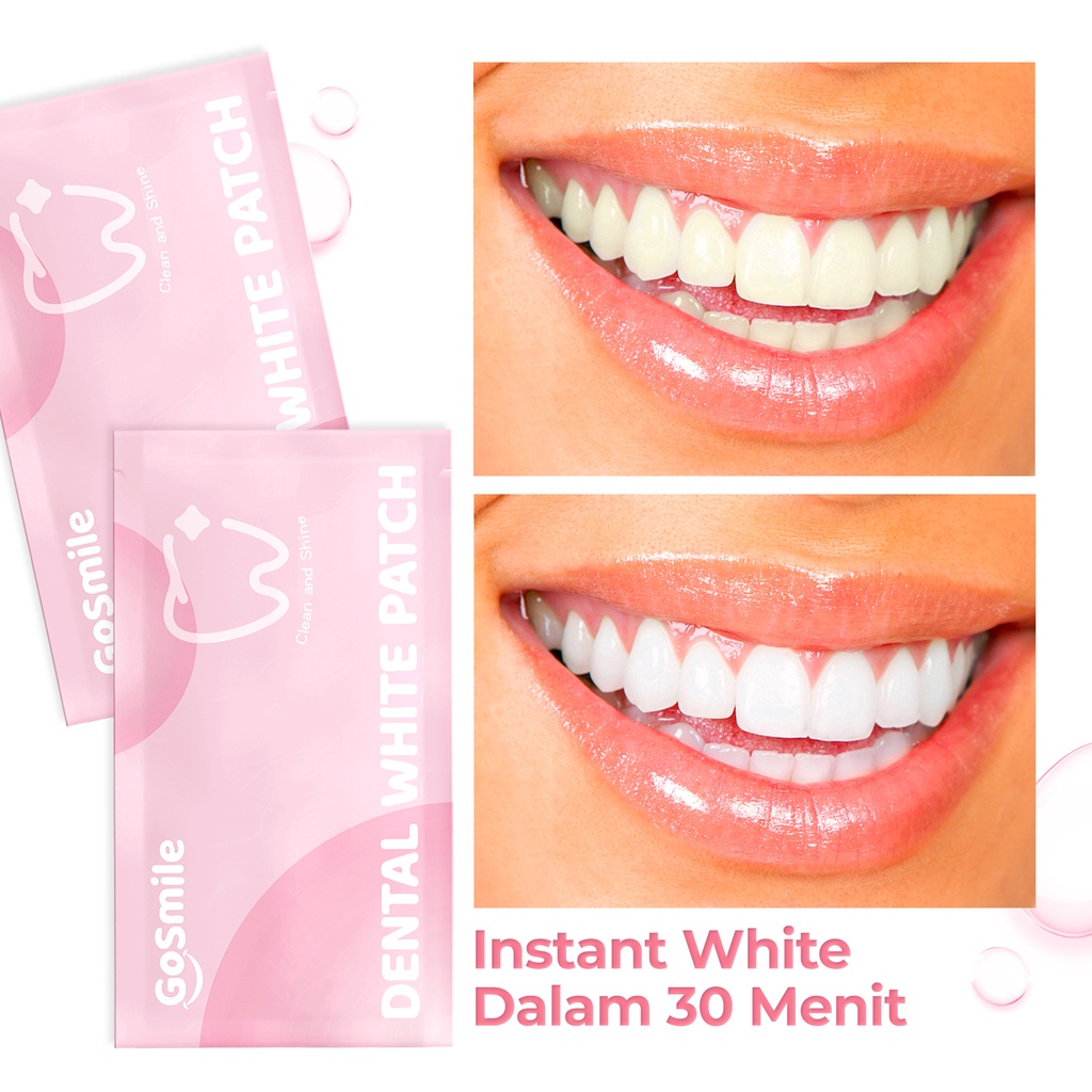 Go Smile Dental White Patch - Untuk Memutihkan Gigi seperti Bleaching dengan Glycerin Menthol dan PVP [BPOM]