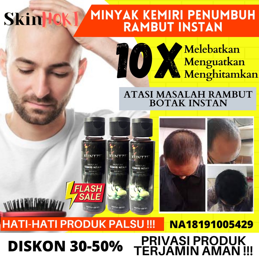 MINYAK KEMIRI PENUMBUH RAMBUT PENGHITAM ALIS MINYAK KEMIRI HITAM KUNTZE 100ML PENGHITAM RAMBUT ORIGINAL BPOM