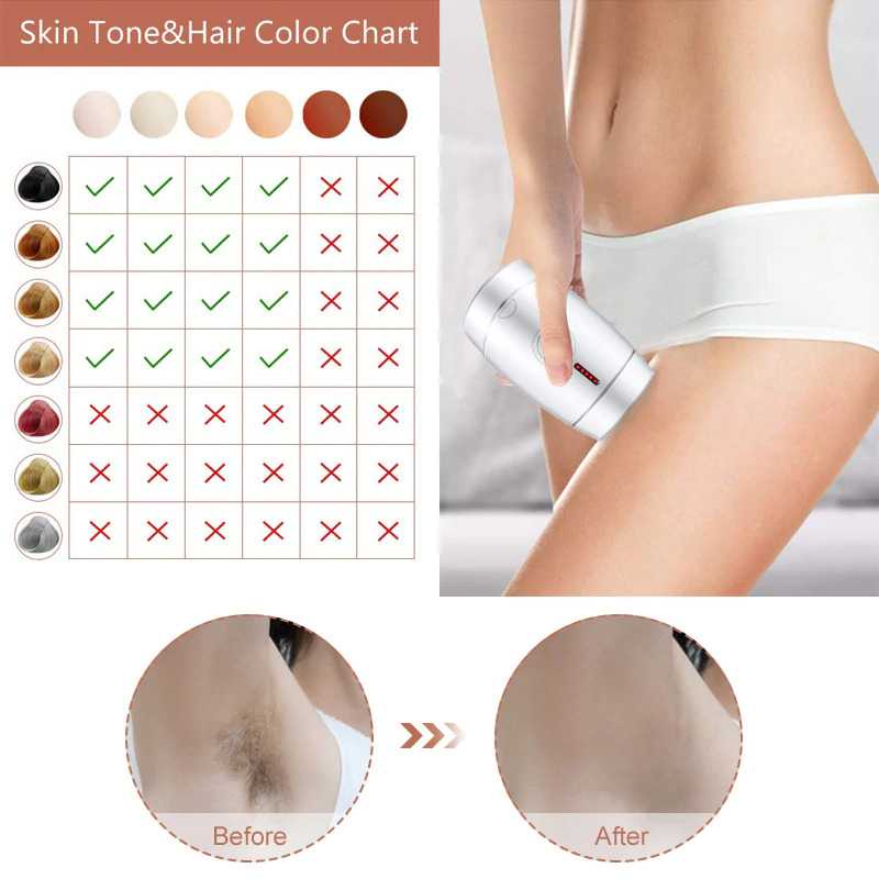 COD Alat Penghilang Rambut Tubuh Ketiak Badan Kaki Tangan IPL Laser Epilator Hair Removal 600000 Flashes