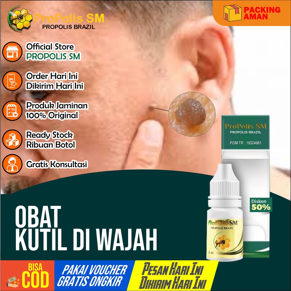 Obat Kutil Wajah Obat Papiloma Wajah Penghilang Kutil Obat Tetes Propolis Sm
