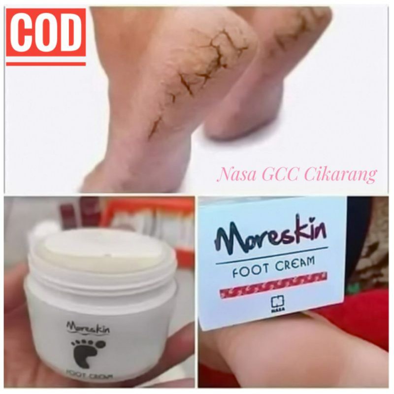 KRIM PERAWATAN TELAPAK KAKI PECAH-PECAH MORESKIN FOOT CREAM