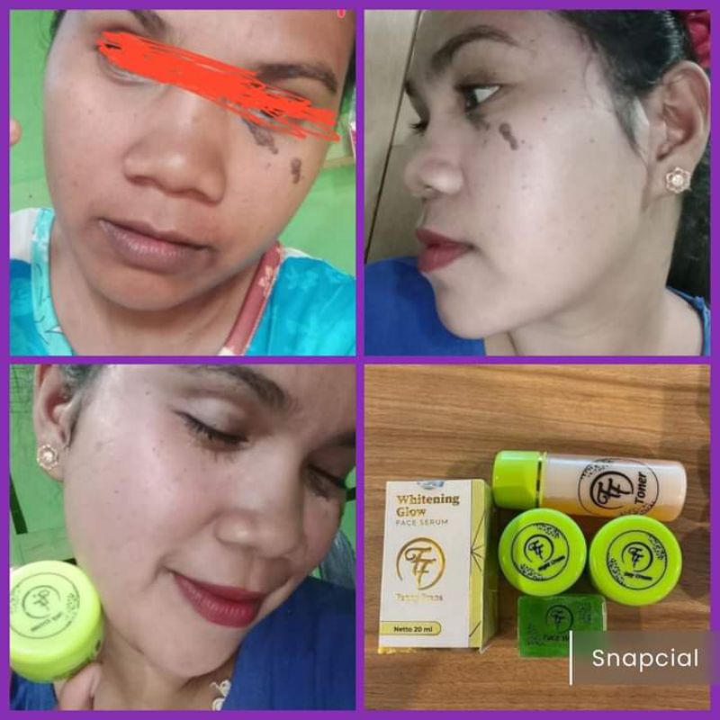 PAKET GLOWING FF