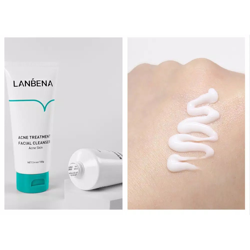 LANBENA Acne Cleanser Treatment Anti Acne Oil Free Pembersih Wajah ORI