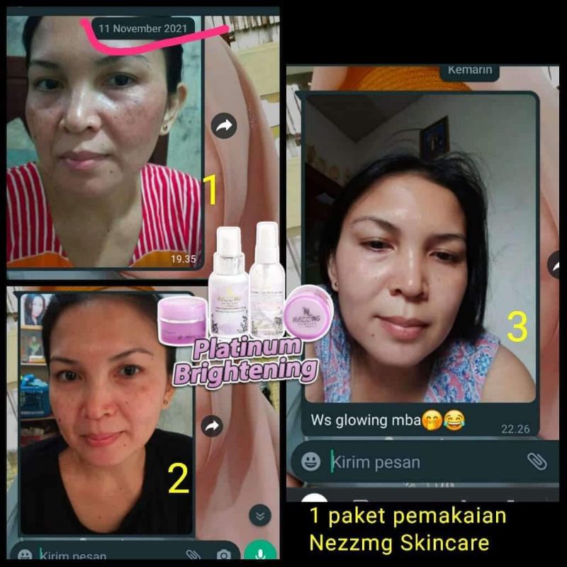 nezzmg platinum brightening