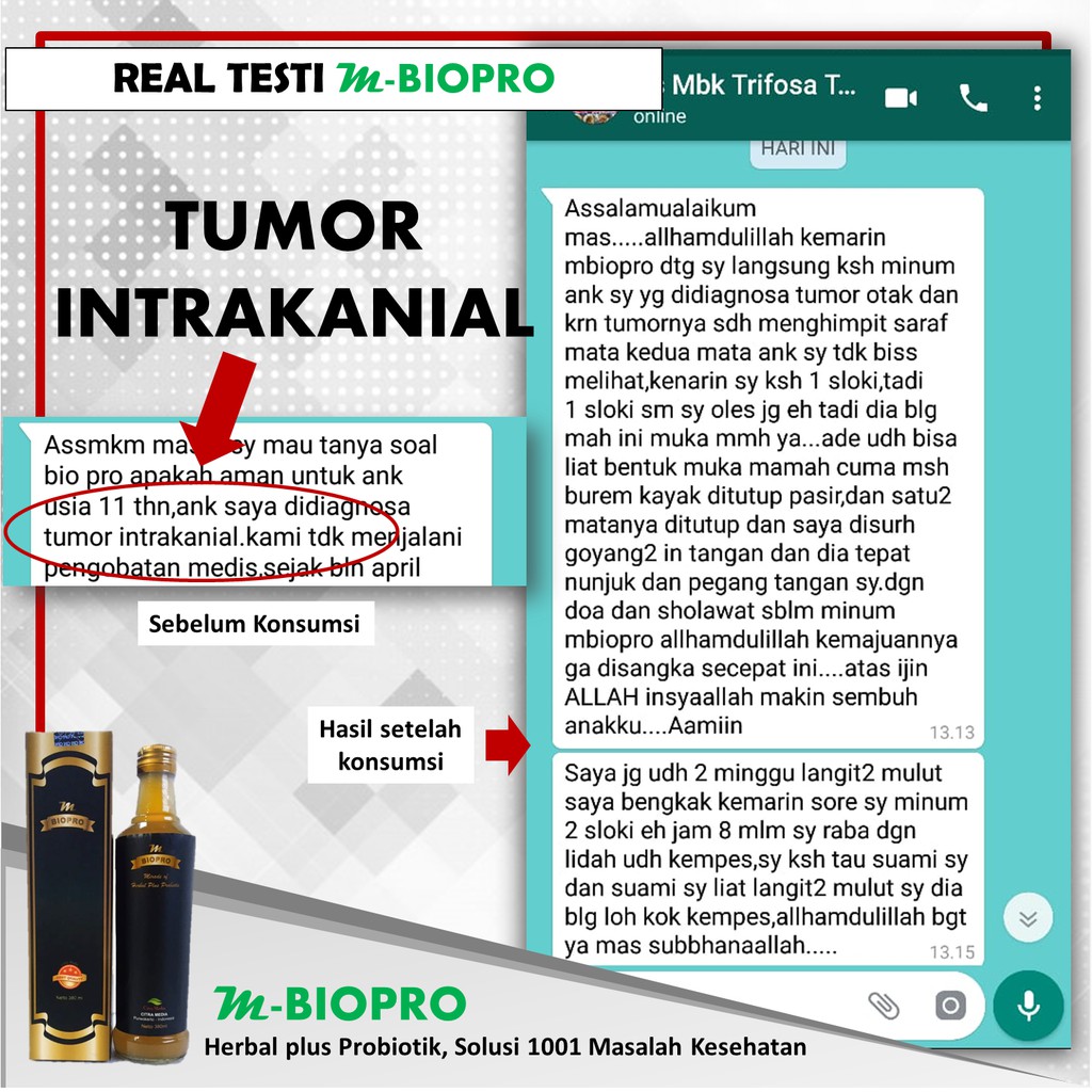 Obat Tumor Jinak | Obat Alami Tumor | Obat Tumor Ganas
