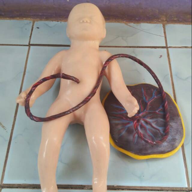 Phantom Bayi Placenta