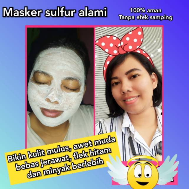 Sabun belerang / sulfur murni