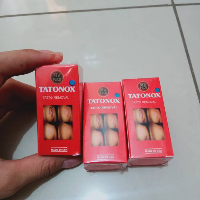 Tatonox (Obat Penghilang Tatto)