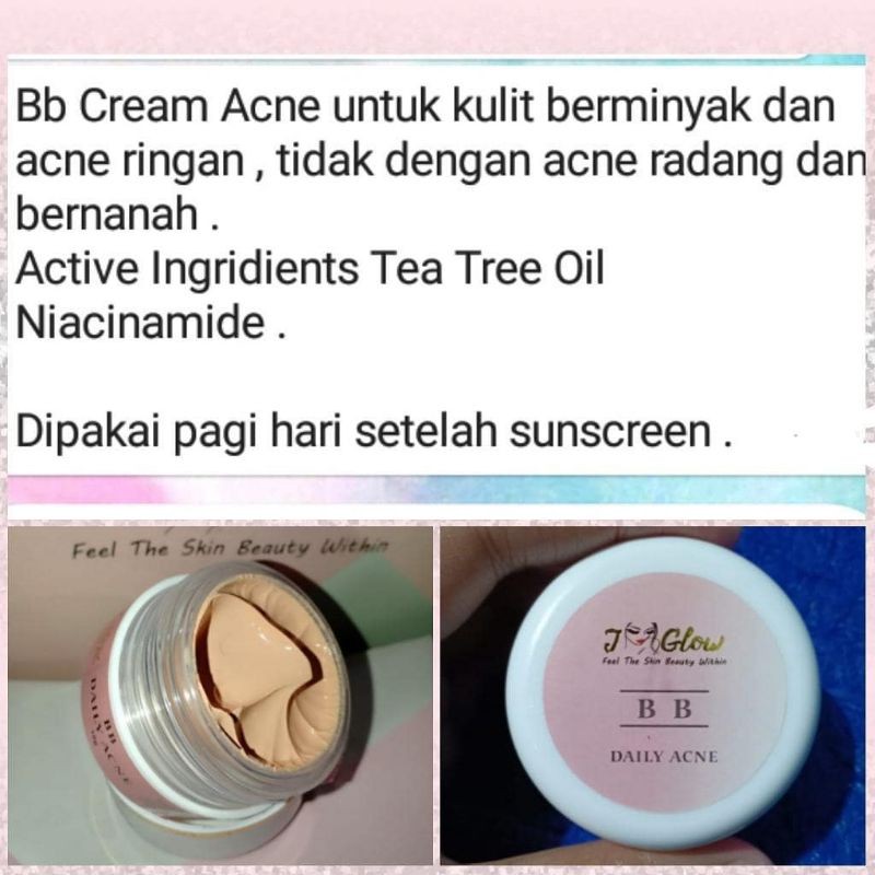 Jglow BB Cream Acne