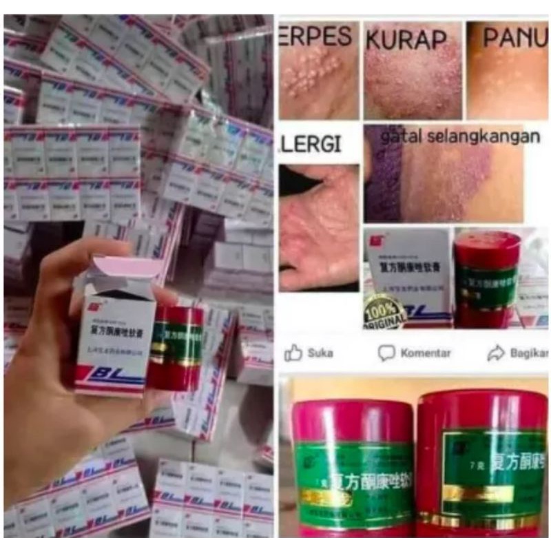 SALEP cream gatal BL 100% original/salep panu,kurap,kudis,salep jerawat.