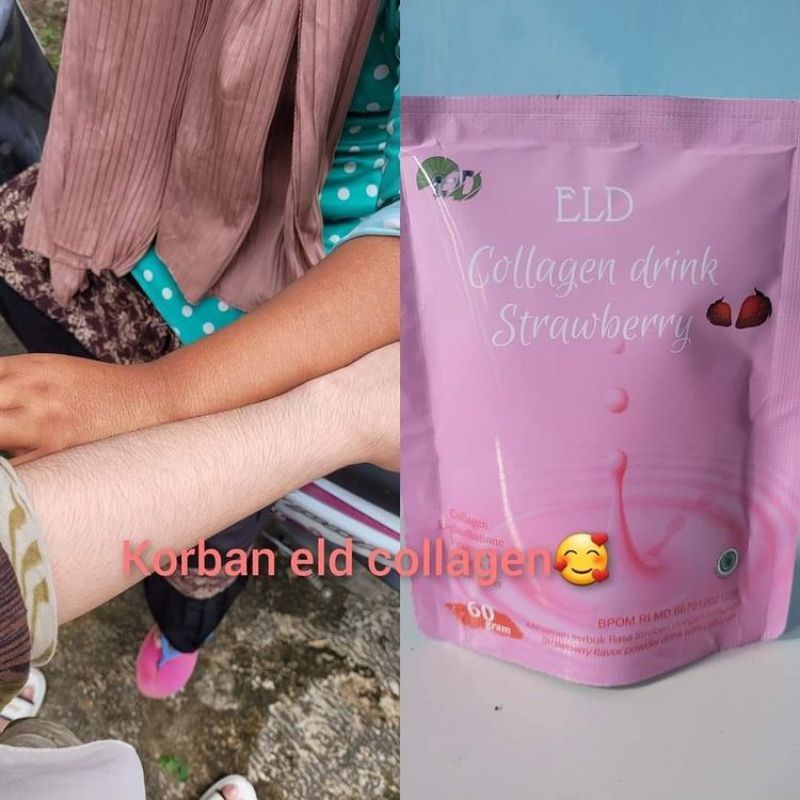 ELD collagen original whitening dan menurunkan berat badan,collagen 2in1mencerahkan dan menurunkan b