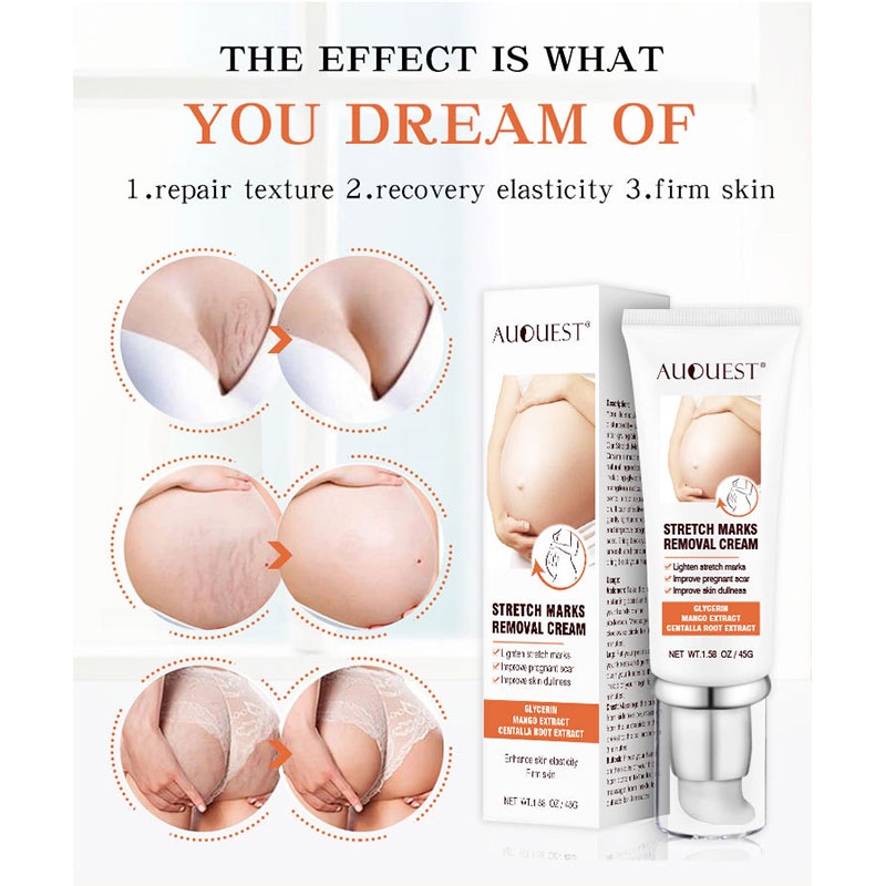 AUQUEST hamil perut tato krim perut firming cream memudar postpartum obesitas stretch mark perbaikan cream