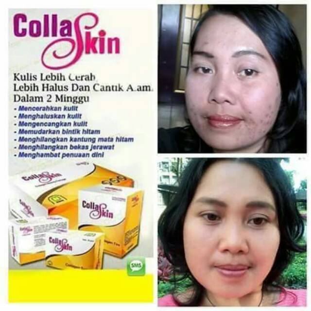 PAKET COLLASKIN PERAWATAN TUBUH ALAMI