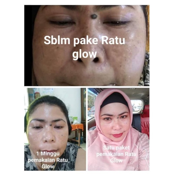 RATU GLOW skincare viral ORI BPOM, aman bumil busui. Varian ECER, mau  varian paket pilih di etalase