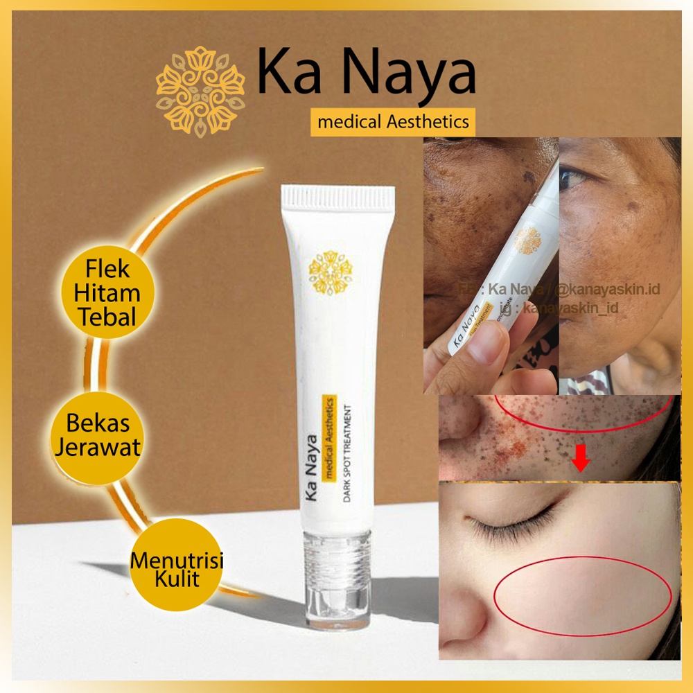 Ka Naya Obat Flek Hitam Bandel  Salep Flek Hitam Ampuh menghilangkan Flek Hitam  Penghilang Bekas Je