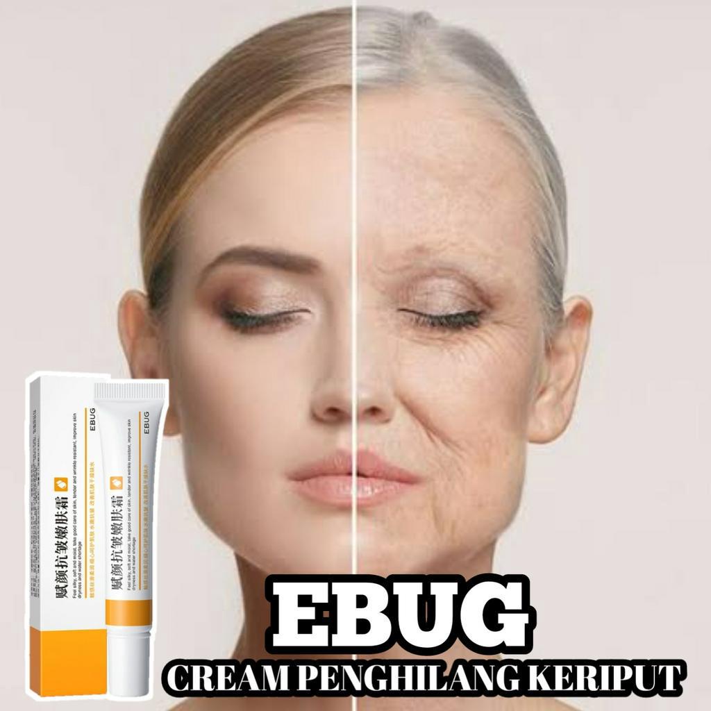 Ebug Whitening Frackle Cream melasma pemutih wajah penghilang bintik hitam dan bekas jerawat