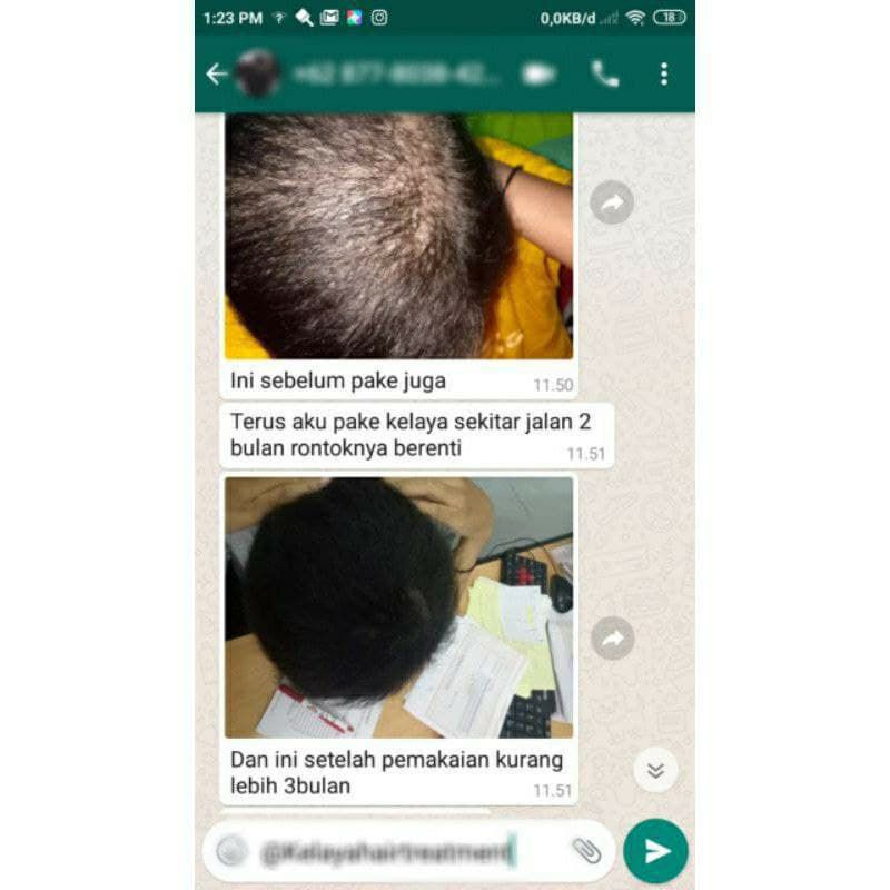 KELAYA HAIR TREATMENT SHAMPOO KELAYA ORIGINAL 100%  RAMBUT ANTI RONTOK / SHAMPOO PENYUBUR RAMBUT / PENGHILANG KETOMBE ISI (250ML) BPOM-7