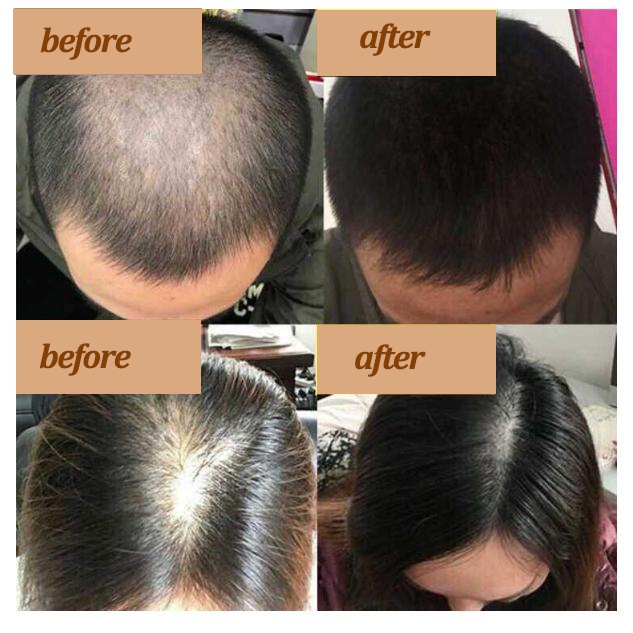 shampo rambut rontok shampo anti rontok Sampo jahe 400ml Anti-hair loss anti ketombe Kontrol Minyak pertumbuhan rambut