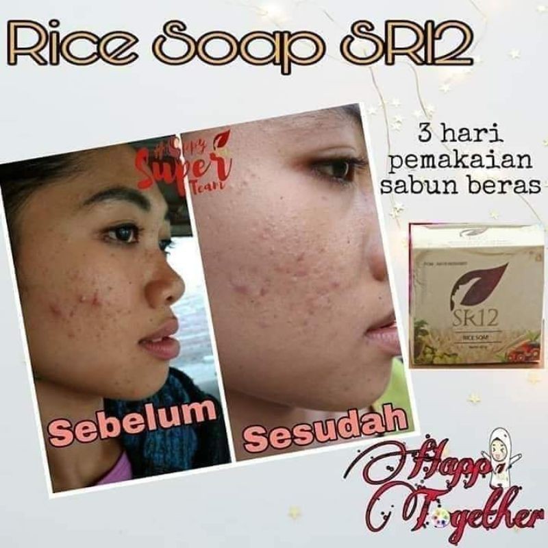 Rice Soap SR12 Sabun Beras Face Wash Sabun Pencerah Alami Saber