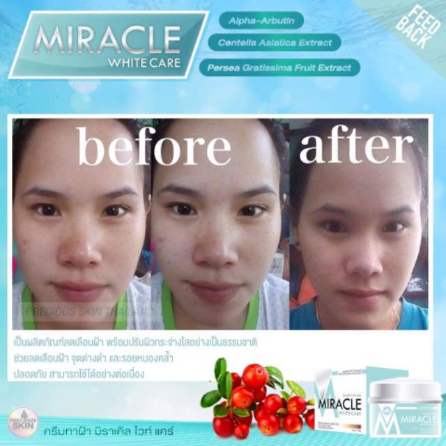 MIRACLE INSTENSIF WHITE CARE CREAM MUKA / KRIM WAJAH / KRIM MUKA / PEMUTIH WAJAH / PERAWATAN WAJAH