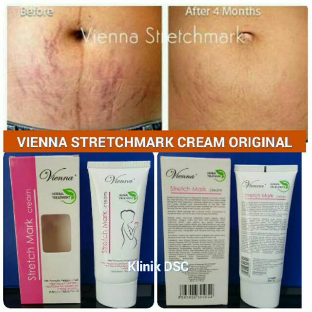 VIENNA STRETCHMARK CREAM CICA+ SOLUTION ORIGINAL - PENGHILANG STRETCH MARK PERUT PAHA