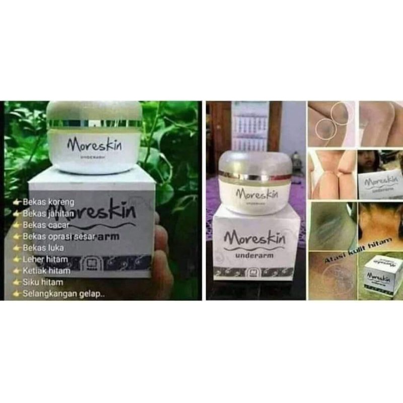 moreskin underarm