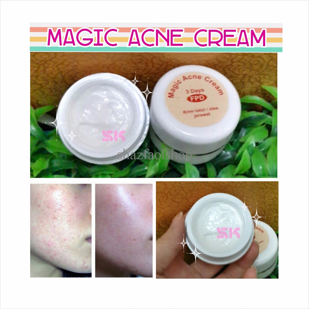magic acne cream