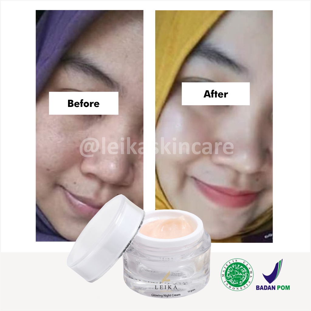 Ampuh! Pelembab Wajah Bikin Kulit Wajah Glowing dan Putih Krim Pelembab Wajah Kering Berjerawat Ampuh Glowing Night Cream Leika Skincare Cream Wajah Glowing Aman BPOM Krim Pe mutih Wajah bpom Glowing Cream Pe mutih Wajah Glowing  BPOM Asli 100% HALAL MUI