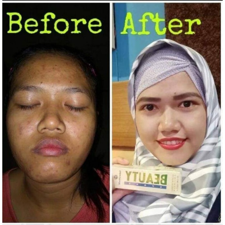 SERUM MULTIFUNGSI NATURA BEAUTY SPRAY ORIGINAL BPOM AMAN DAN NATURAL