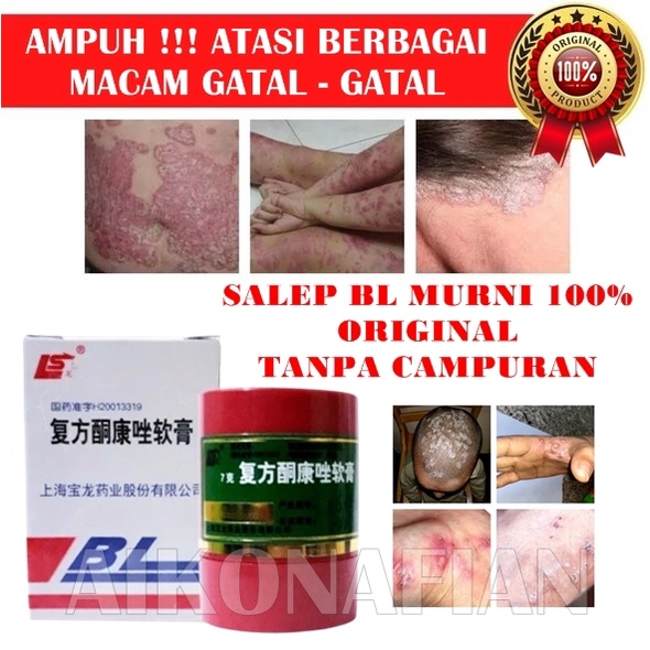 Obat Kulit Eksim, Obat Gatal Kulit Eksim, Obat Eksim Kering,