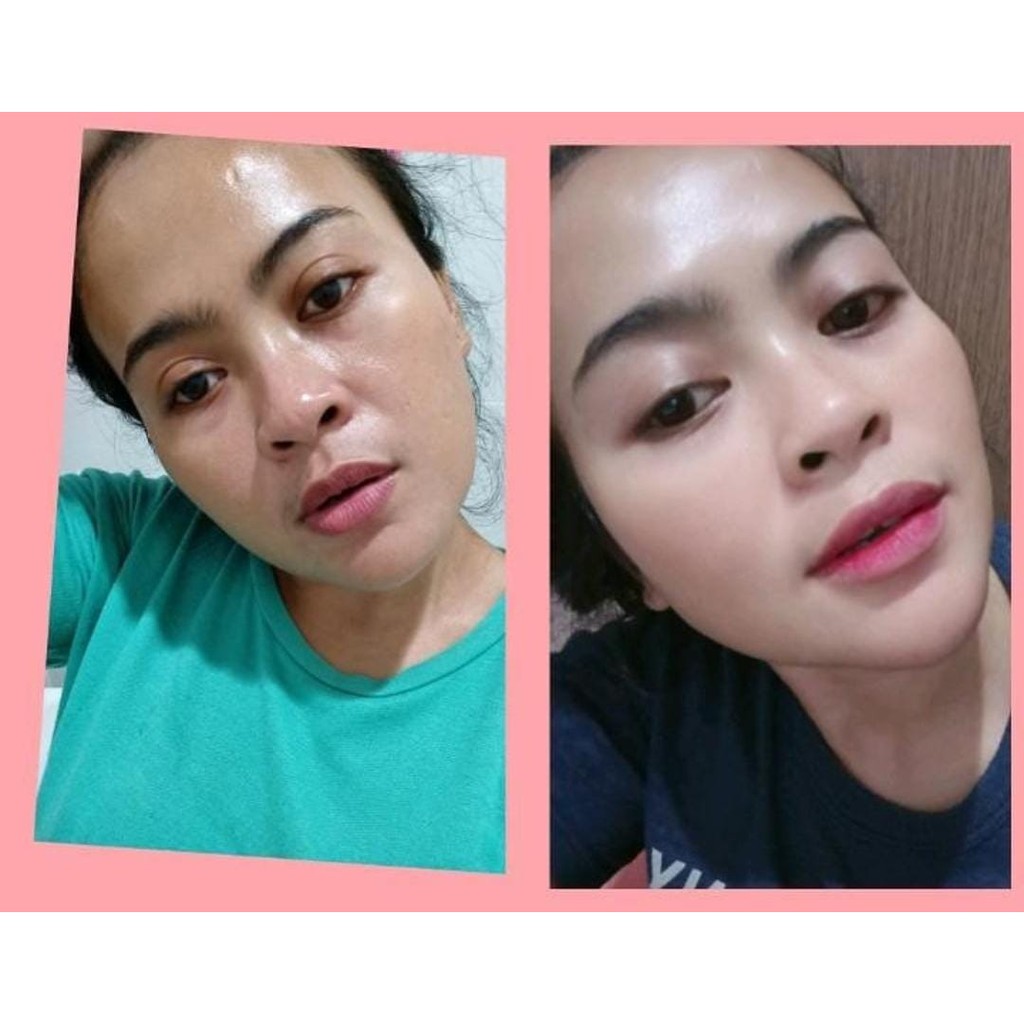 PAKET GLOWING BPOM PAKET SKINCARE THERASKIN PAKET GLOWING ORIGINAL BPOM SUNCARE THERASKIN KRIM PAGI KRIM MALAM TONER WAJAH FACIAL WASH PERAWATAN WAJAH SKINCARE BPOM KRIM SIANG MALAM