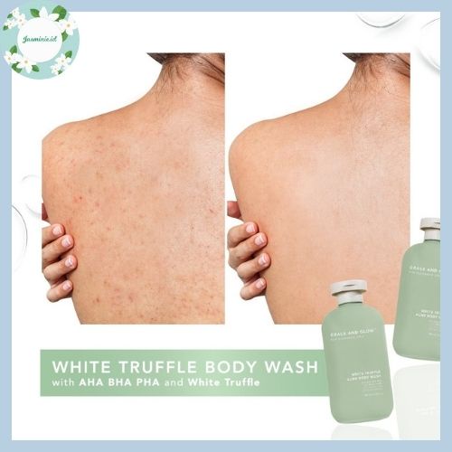 [PROMO!] Grace and Glow White Truffle Acne Body Wash Sabun Mandi 400ml