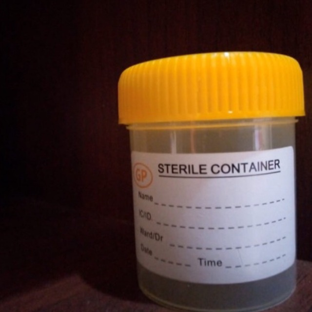 Pot urine steril 60ml