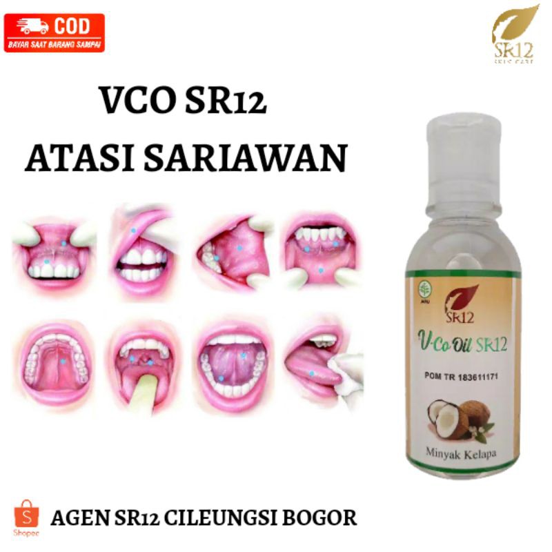 Jual VCO SR12 OBAT SARIAWAN/OBAT SARIAWAN ANAK BPOM/OBAT SARIAWAN ALAMI ...