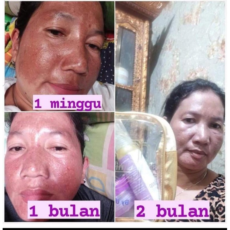 ubc skincare by umi alfatih